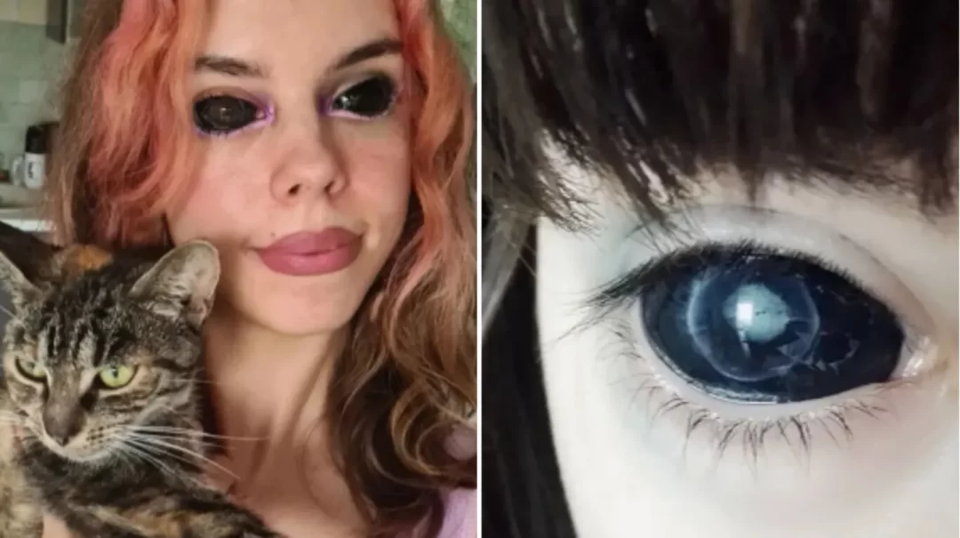 Joven queda ciega tras tatuarse los ojos para parecerse a su ídolo rapero